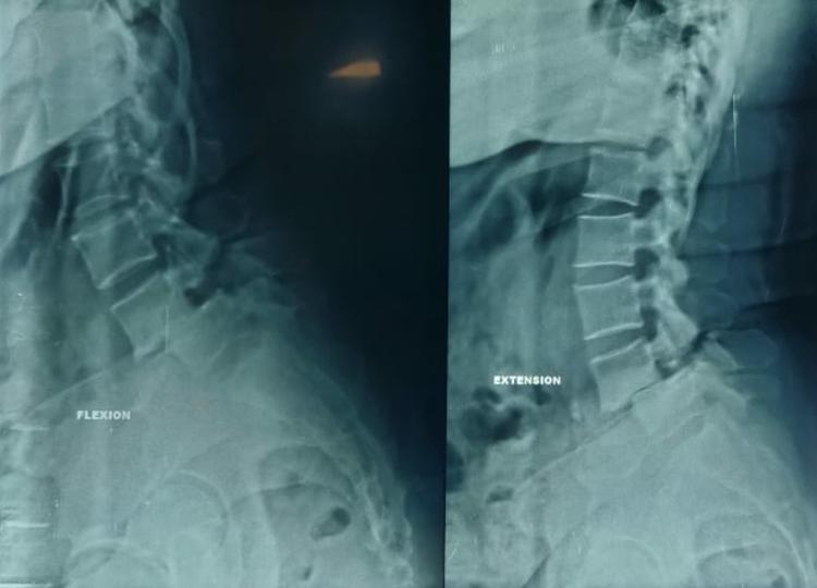 Preop Image 1