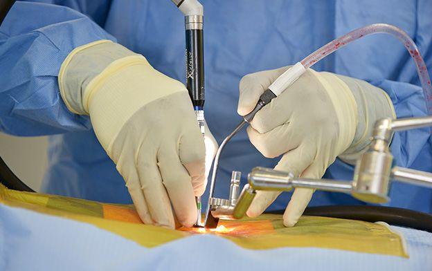 Minimally Invasive Spine Surgery