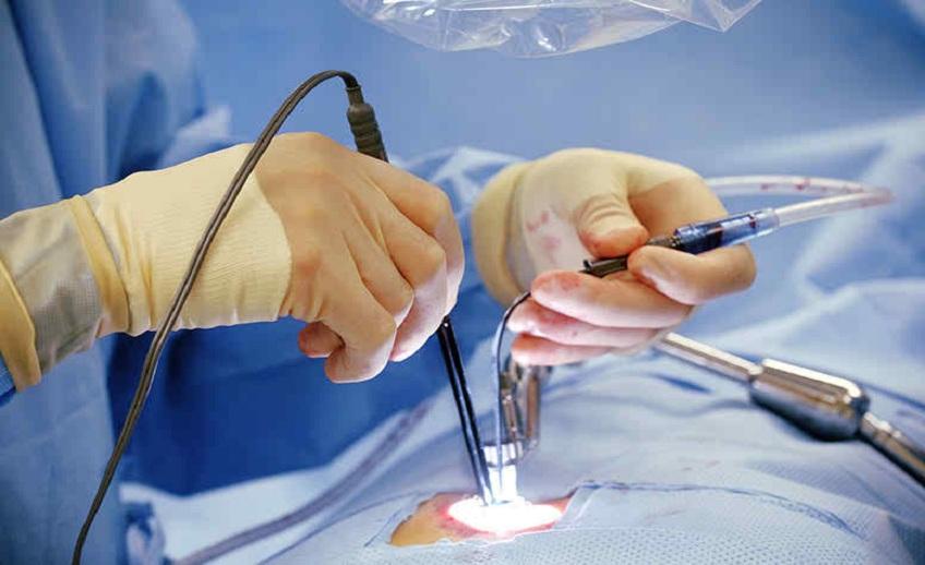 Endoscopic Spine Surgery